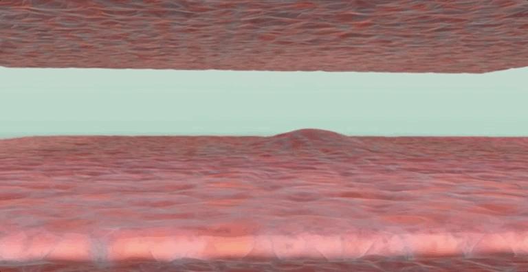 揭秘伤口如何愈合的,伤口是如何愈合的告诉小朋友