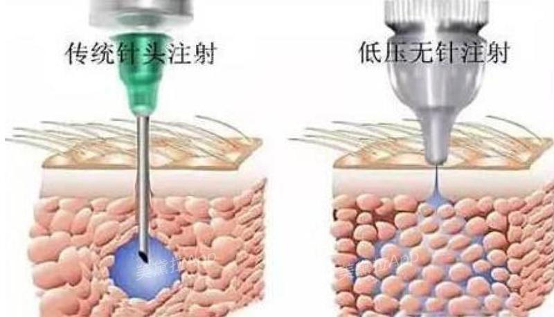 秋冬沙漠干皮巨补水的水乳,沙漠肌补水护肤水