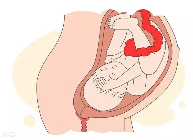 怎么判断胎头完全入盆,自己在家如何判断胎头是否入盆