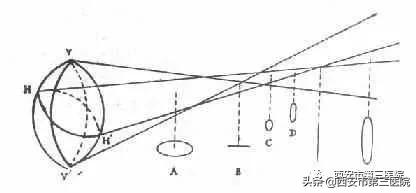 眼科医生怎么知道你有散光,眼科知识常见问题大全