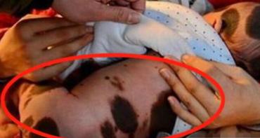 孕妇生下斑点狗宝宝,斑点狗一胎生宝宝