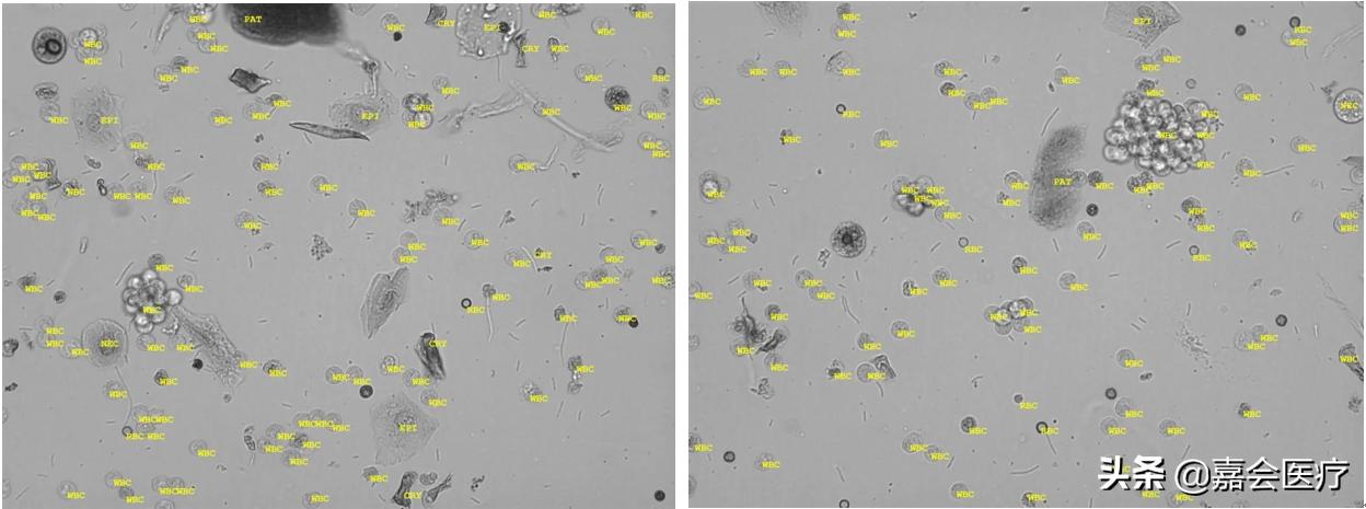 尿液突然变红、变绿？注意这些常见药会改变尿液颜色