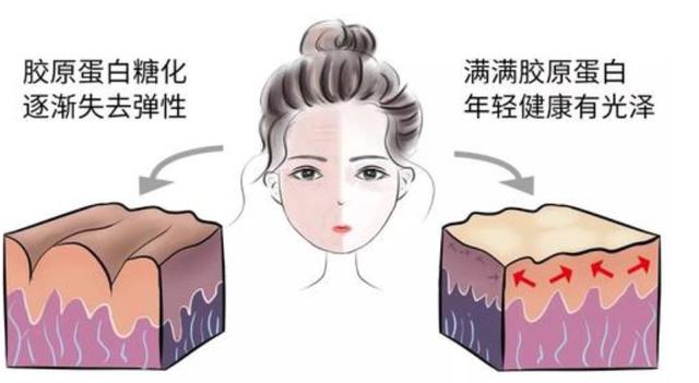 眼睛下面有很多皱纹干纹细纹,脸上有干纹细纹用什么护肤