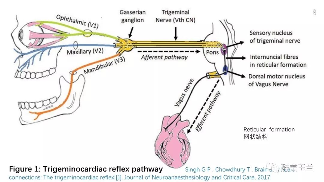 病例分享丨三叉神经节微球囊压迫术的麻醉管理
