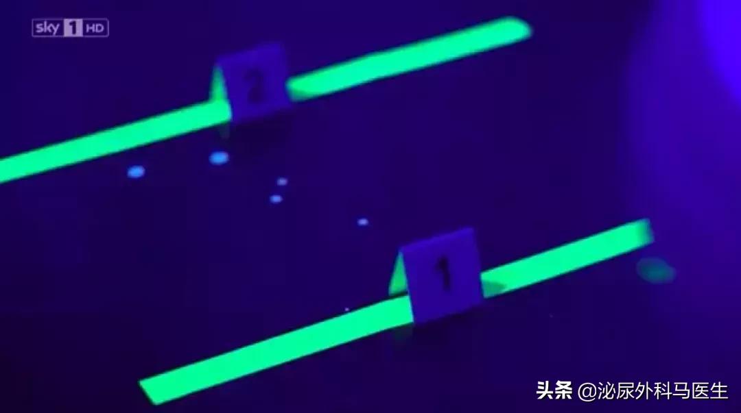 商场里厕所自动冲水引发尿路感染,马桶冲水尿路感染