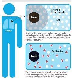 癌症疫苗最新研发消息,癌症疫苗或将问世