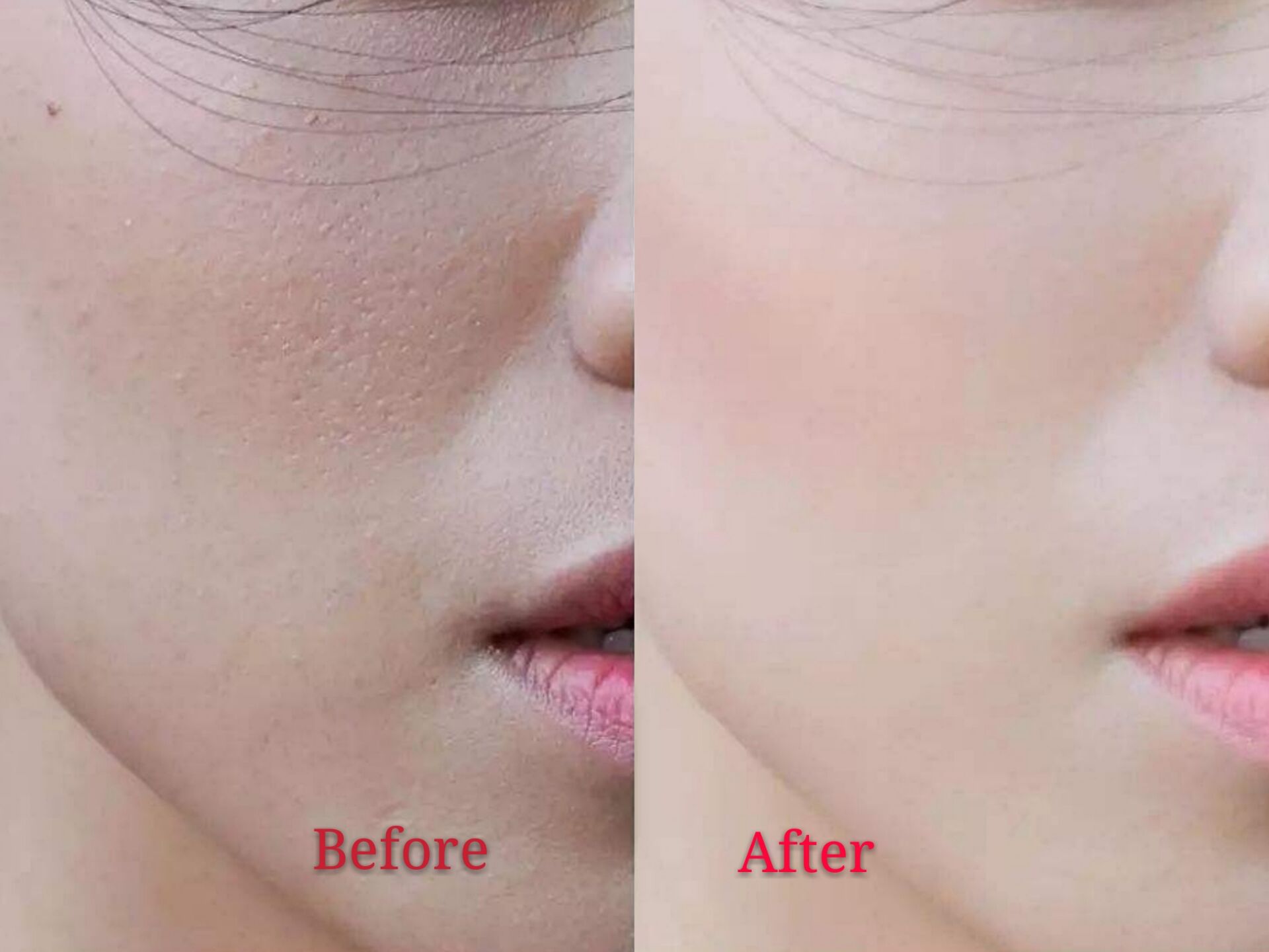 屈臣氏必买面霜,屈臣氏断货王面霜