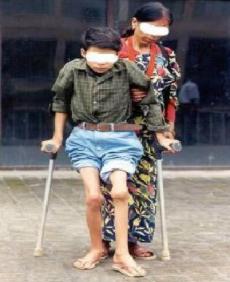 血友病相关知识,小儿血管性血友病