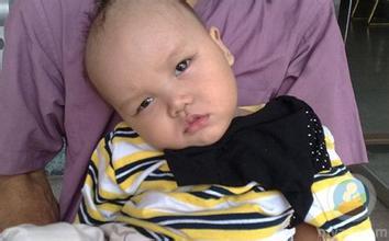 新生儿哪些症状需要警惕,新生儿医生说脑损伤很严重怎么办