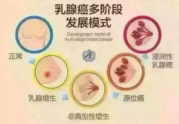 涔宠吅澧炵敓涓尰娌荤枟,涓尰鎺ㄦ嬁涔宠吅澧炵敓