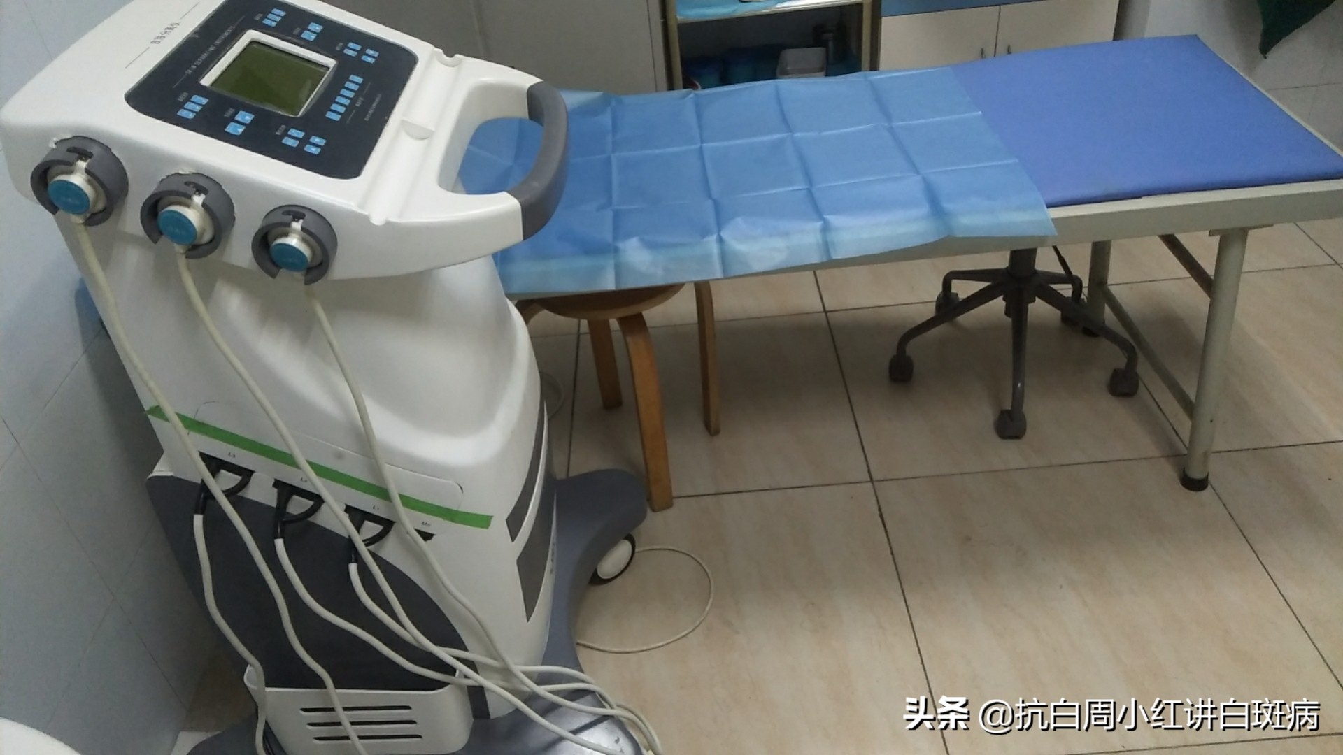 白癜风诊断标准无荧光是啥意思,白癜风早期如何治疗才有效