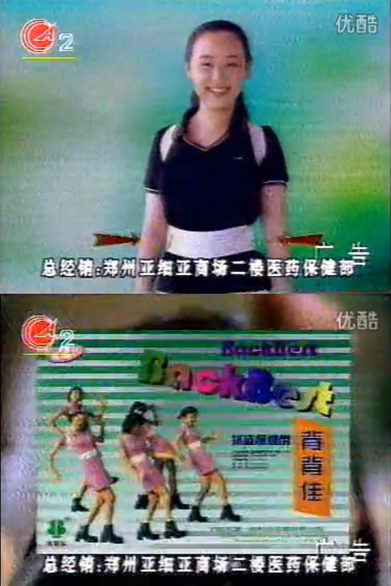 什么是脊椎病呢,颈椎病最严重的是哪种