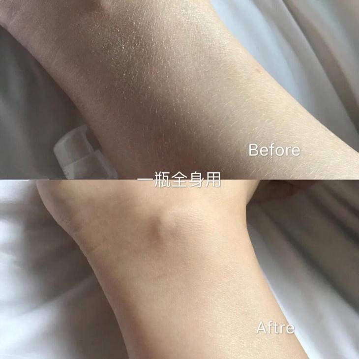 海豹油皮肤,海豹油外用美白效果怎么样