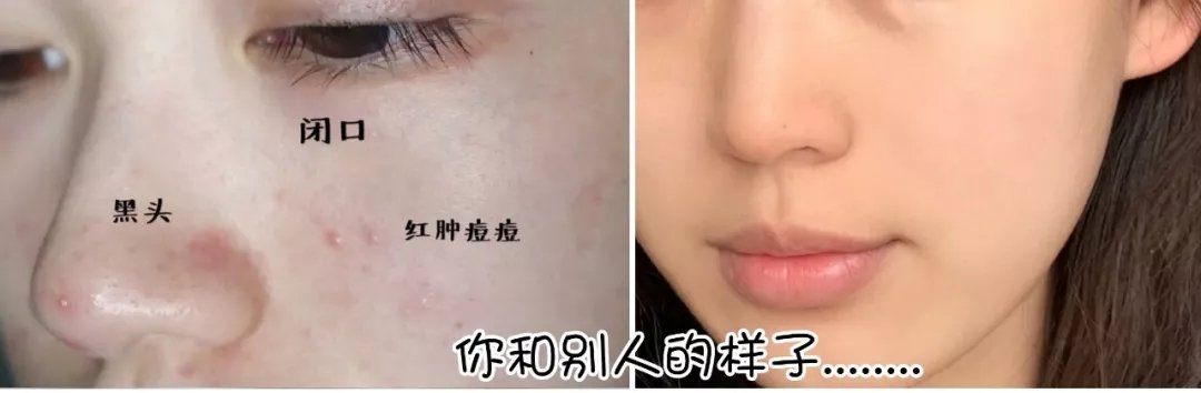 精华应该怎么选？挥别错的才能和对的相逢