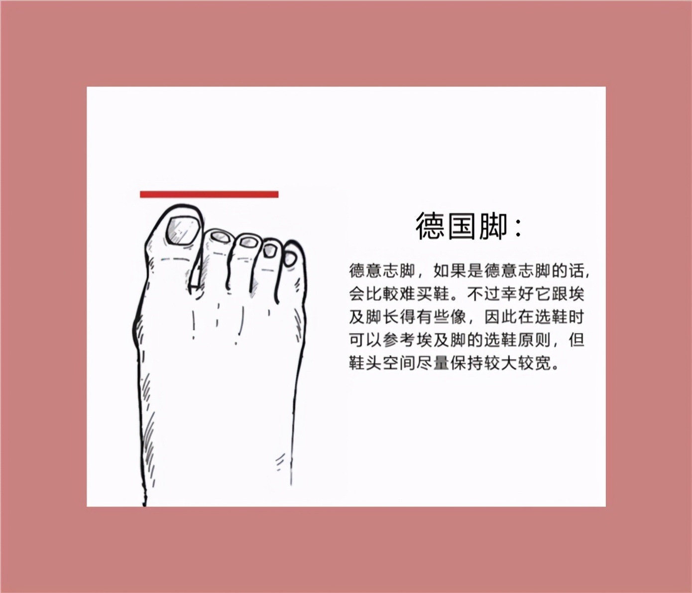 不同脚型适合的鞋子,鞋子不一定要贵只要合脚就行