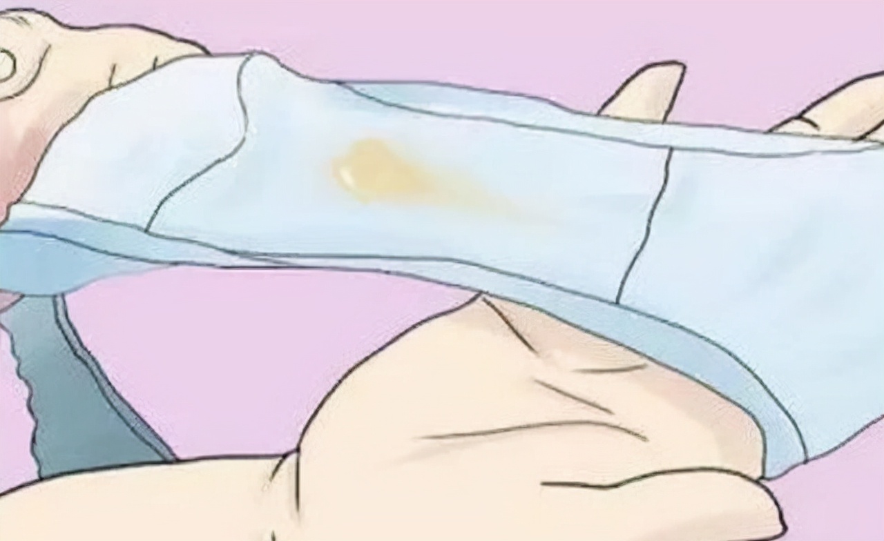 裤衩老有黄色分泌物是怎么回事,女裤有血丝怎么回事