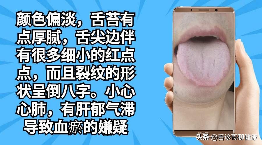 舌诊哥聊健康调脾胃,舌诊哥聊健康