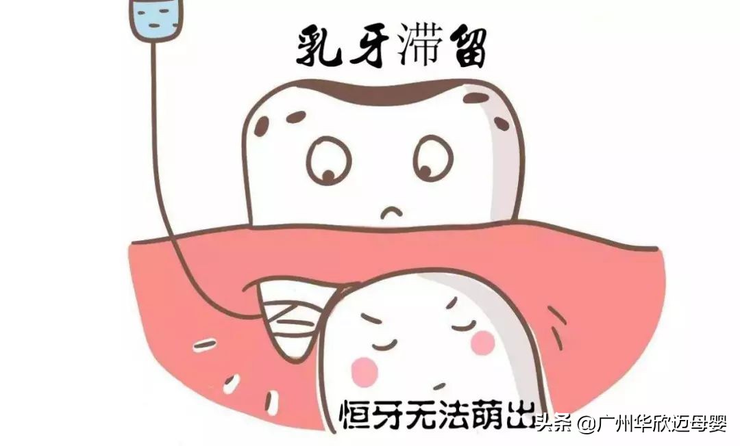 换牙的时候要注意哪些事情,宝宝换牙怎么护理牙齿才能长整齐