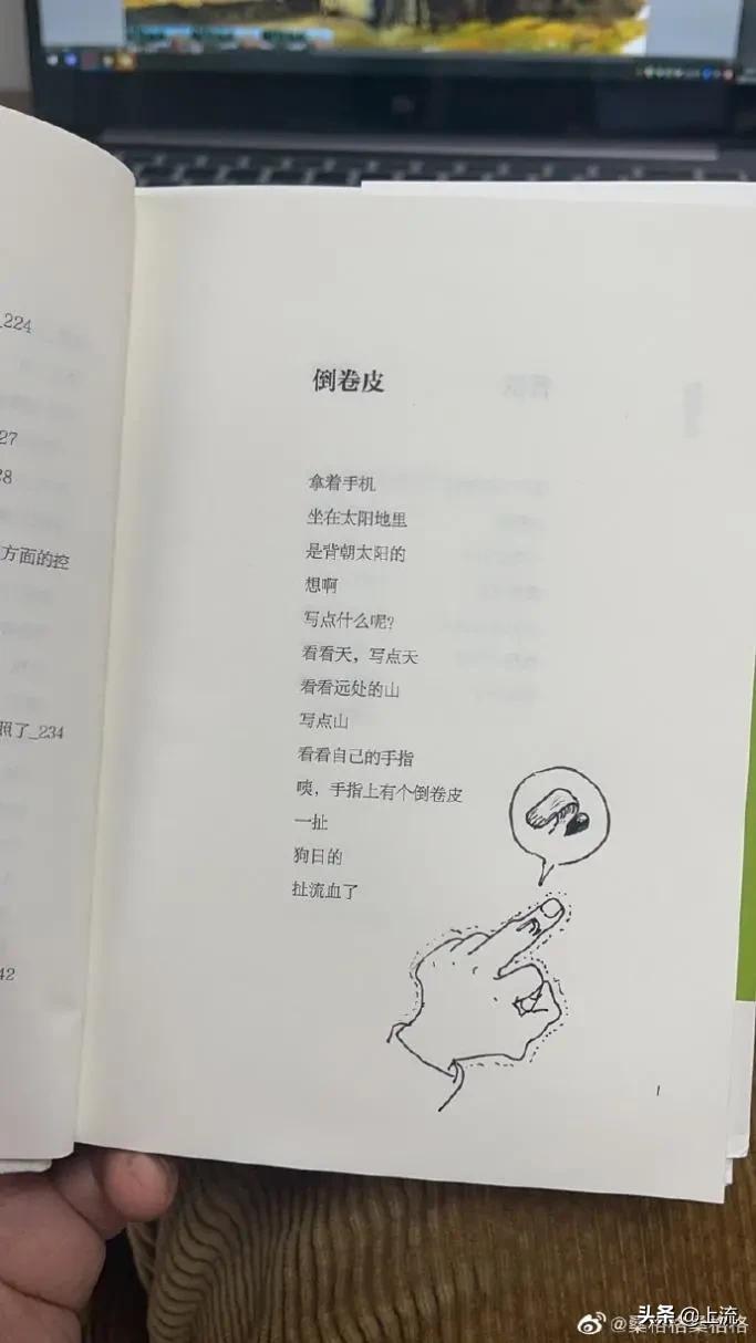 为什么拔倒刺会觉得舒服,忍不住拔手上倒刺怎么办