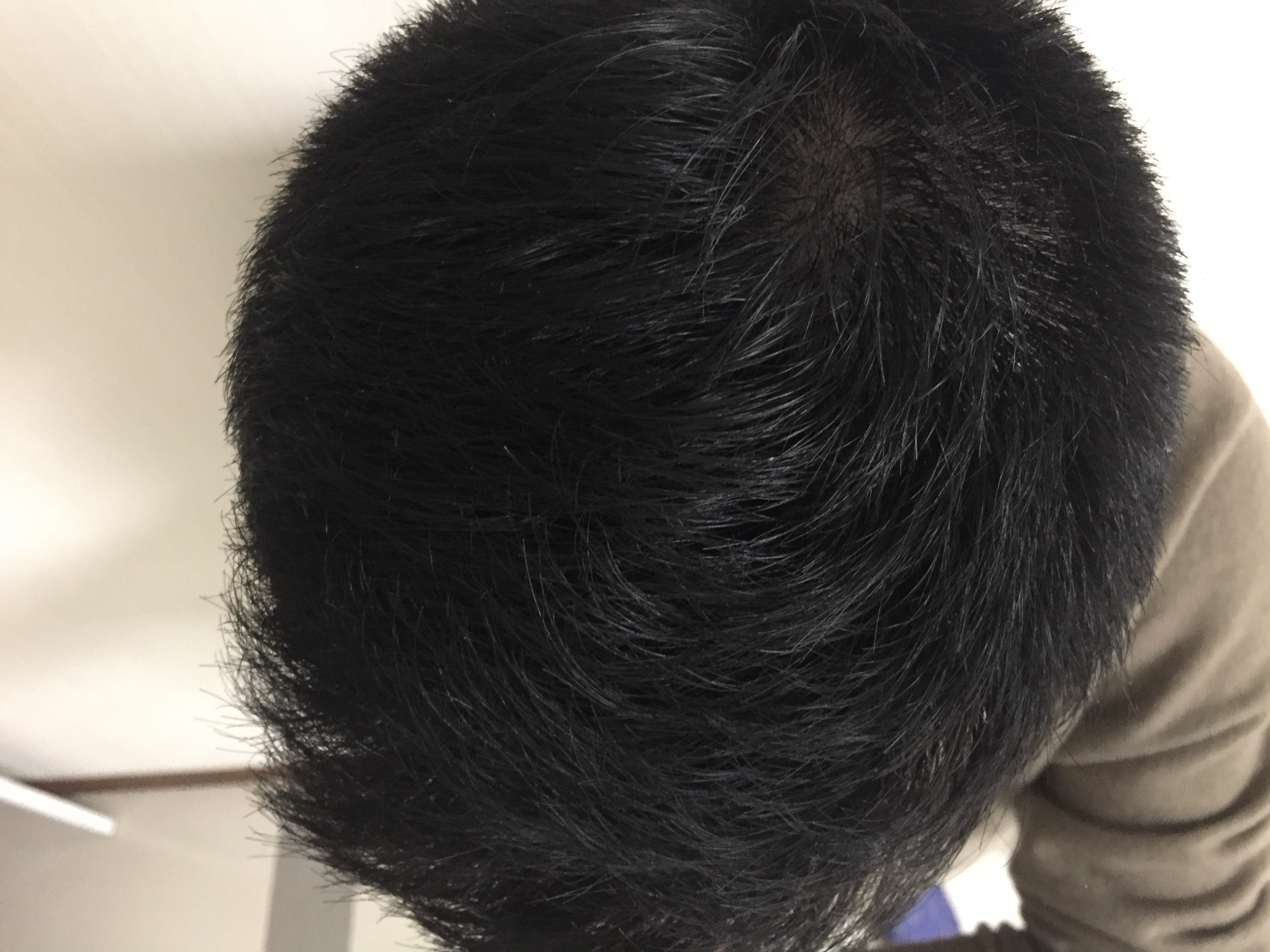 男士护发防脱大作战—我的头发养护四重奏