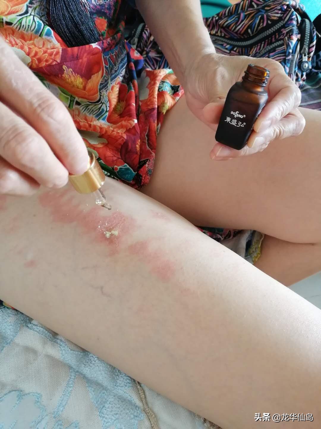 蟒蛇油使用案例与方法