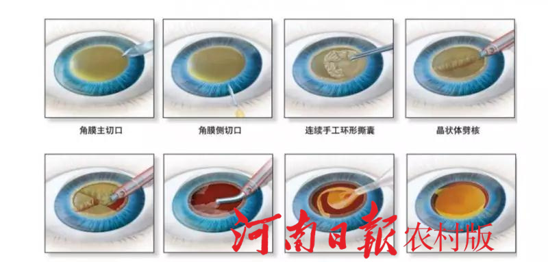 潢川中医院眼科,潢川县人民医院新院区