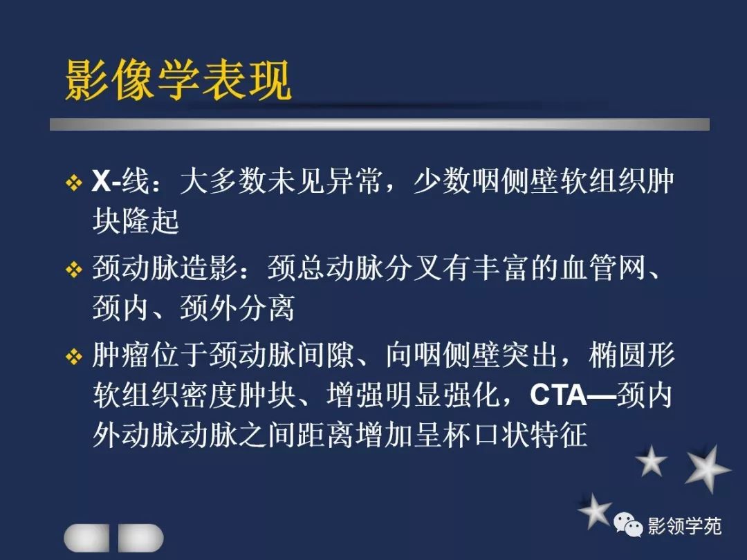 腮腺疾病影像学诊断,腮腺肿块影像诊断