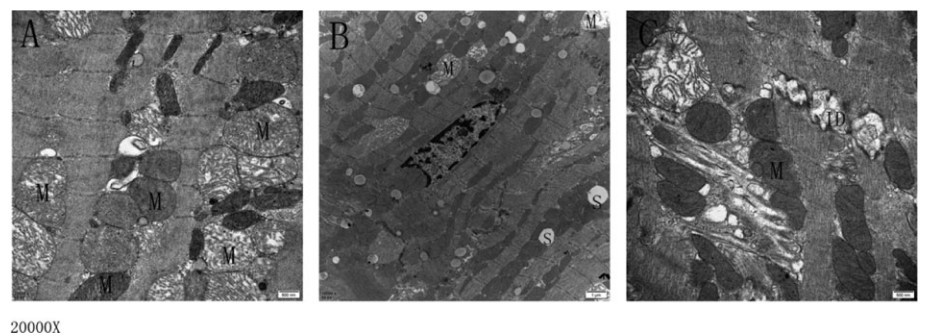 北京协和医院治心脏好吗,体外心脏震波治疗系统