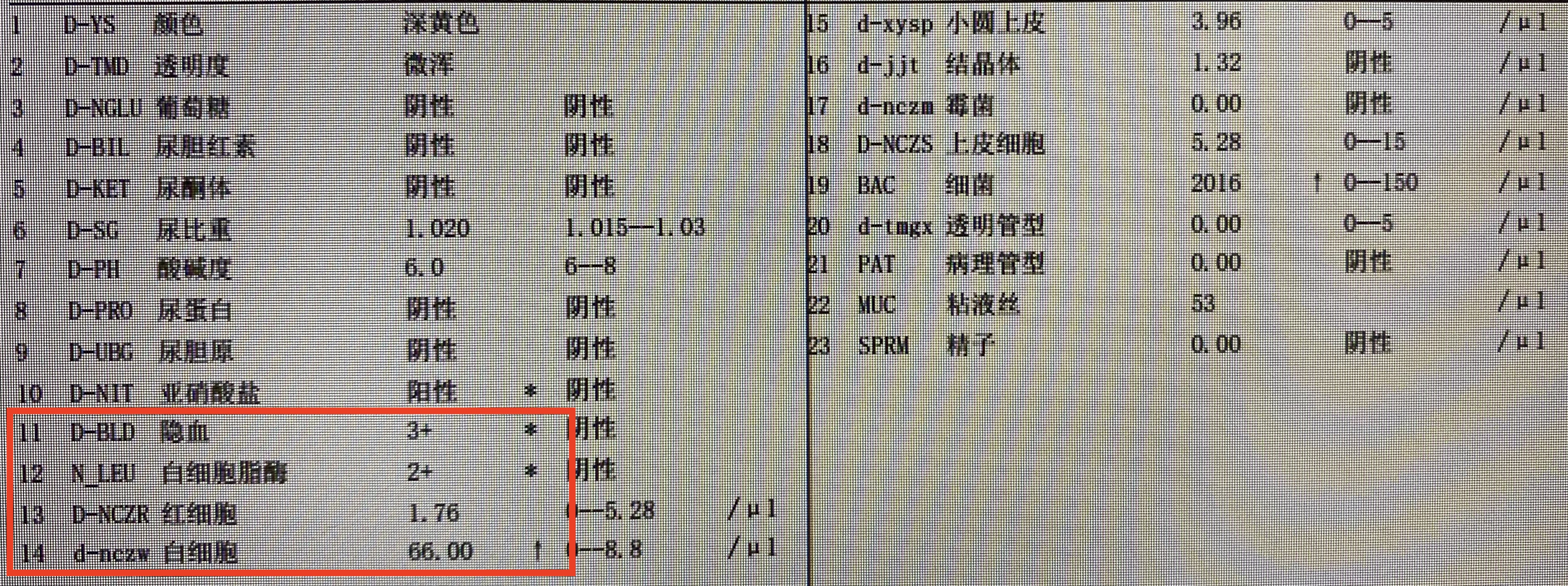 尿隐血3+是不是尿道炎,尿常规隐血3+红细胞高是肾炎么