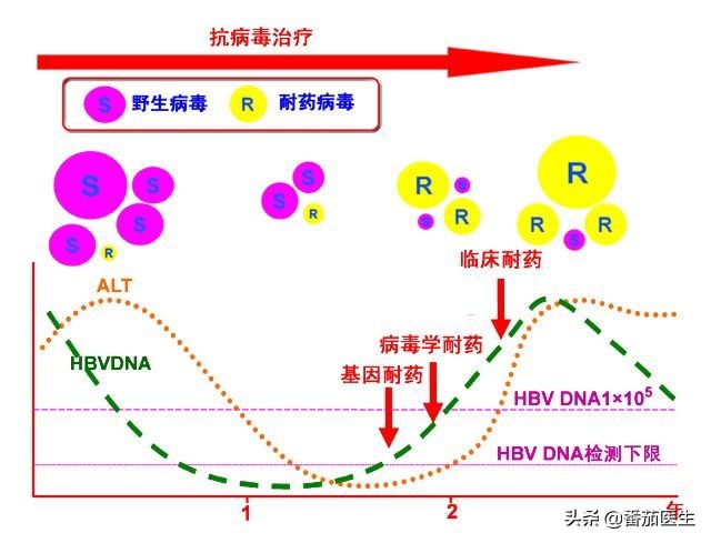 乙肝新药三期临床,进入三期的乙肝新药什么时候上市