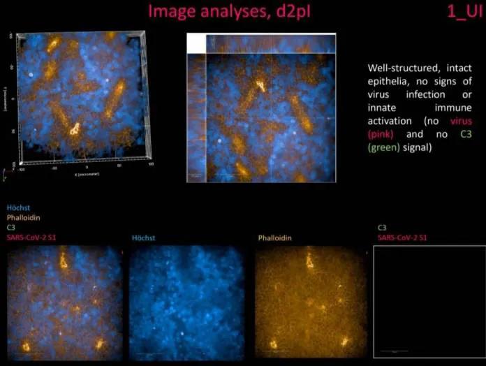 泰国朱拉大学药剂师团队成功研发预防新冠喷雾剂