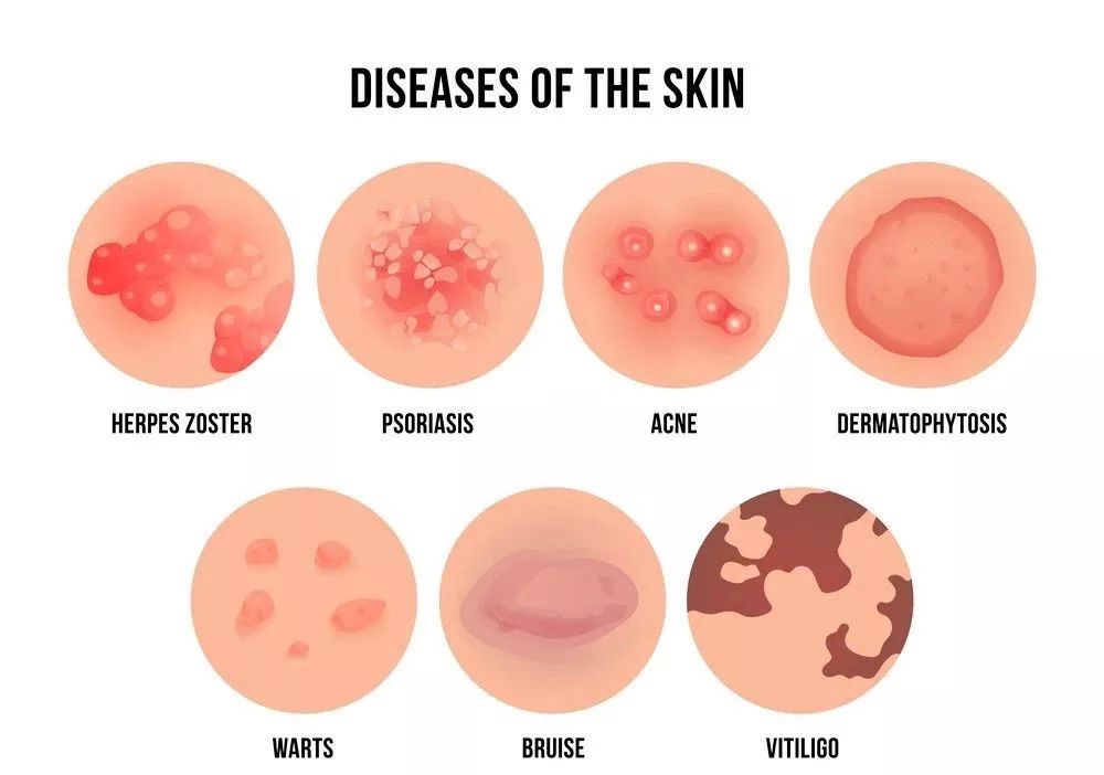 谷歌皮肤科医院怎么样 (谷歌皮肤病专科医院)