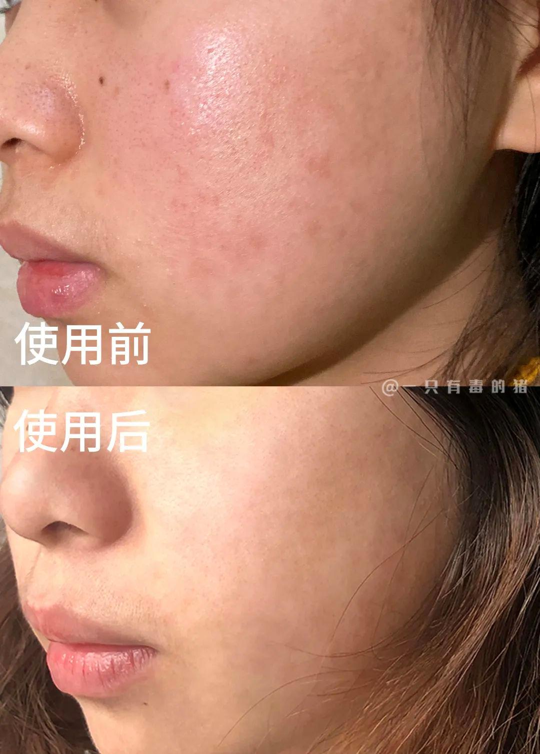 几十块的美白好物,几十块美白精华100ml