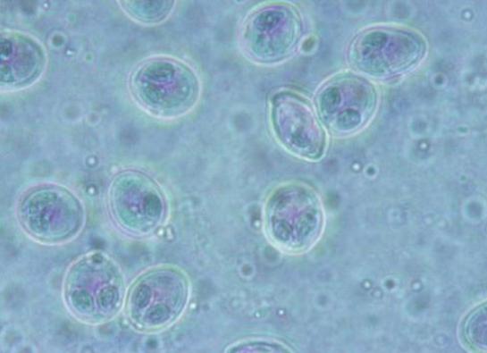 有什么好方法治孢子虫,孢子虫怎么防治