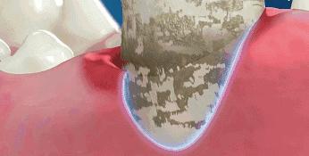 去除牙渍最好的牙膏,去牙渍亮白口气清新最好用的牙膏