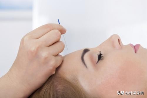 “头痛医脚，脚痛医头”是庸医？NO！针灸治疗能这样的才是良医