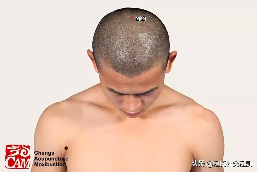 头痛厉害的一招解决方法,最严重的头痛有哪些