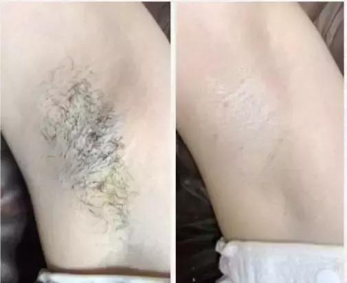 不做猕猴桃女孩是什么意思,不做猕猴桃女孩的图片