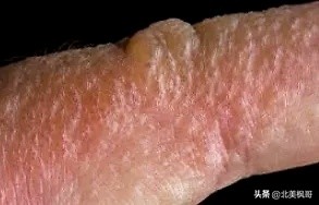 在加拿大最危险的五件事情,加拿大有什么危险动物或昆虫