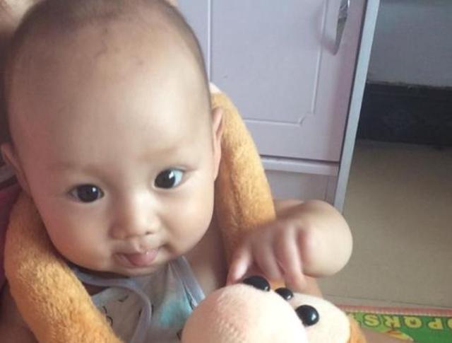 宝宝头发稀少原因及解决方法,头发有的地方浓密有的地方稀疏