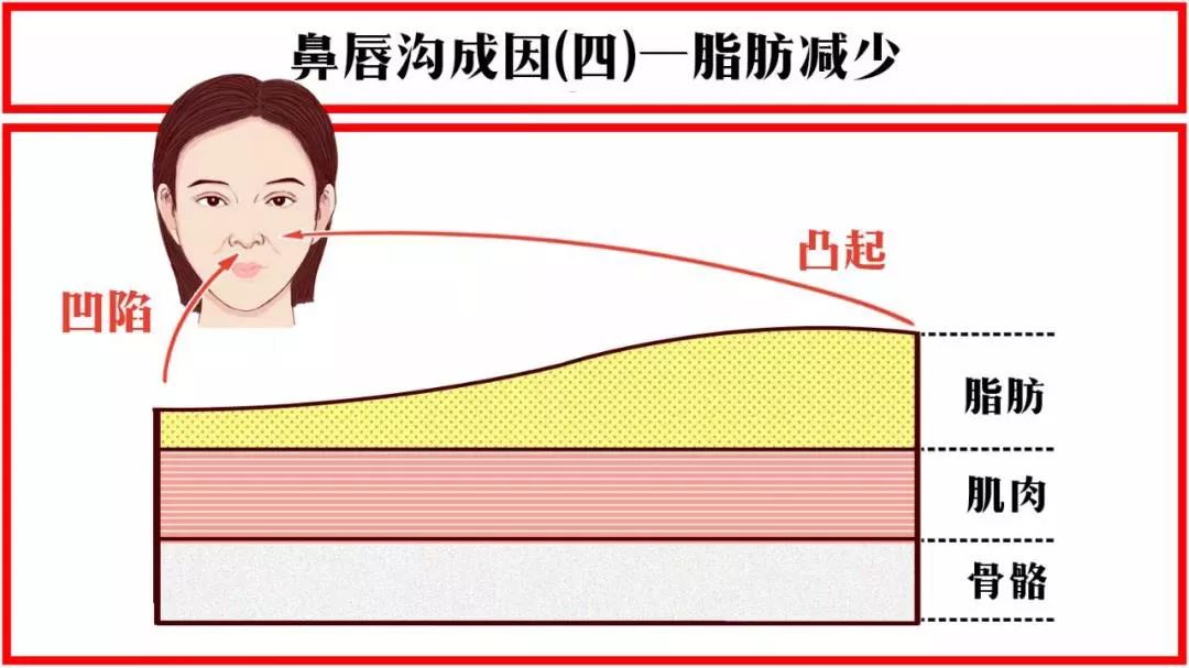 法令纹显老10岁三种方法帮助改善,最显老的法令纹怎么改善