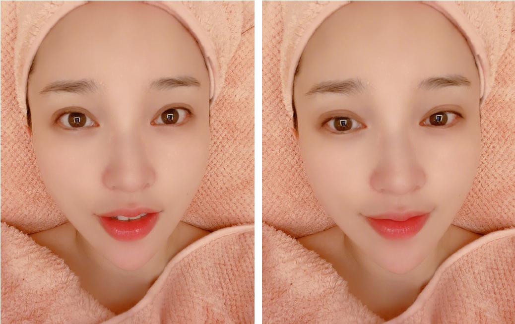 金莎过度按摩导致筋膜黏连，塑造小脸的按摩手法