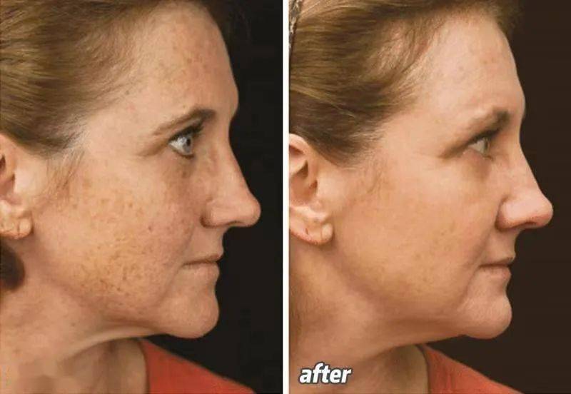 奥运选手都做了美甲,奥运换头选手