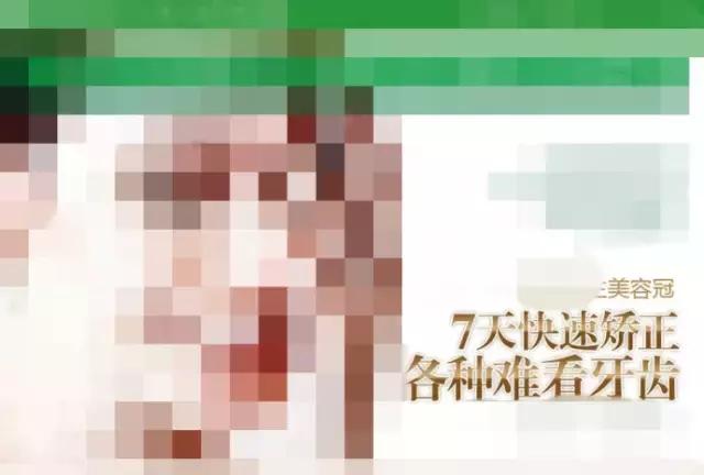 美容冠是什么样,美容冠是什么样的