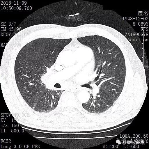 怎么应用统计学做调查,统计学方法可以解决的主要问题