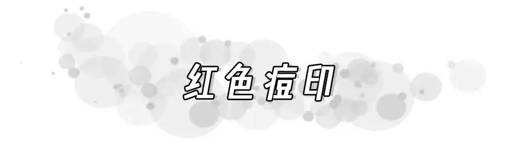 痘印反反复复怎么办,痘印一直反反复复怎么办