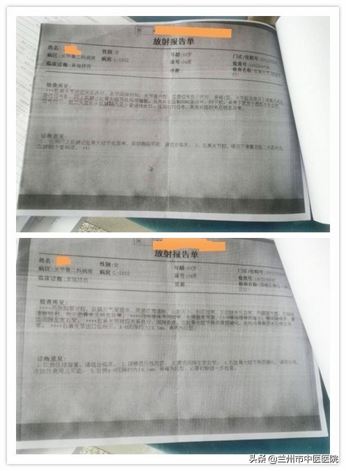 肩袖损伤济南哪个医院治疗好,兰州肩袖损伤手术最好医生