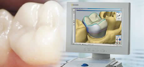 牙齿矫正和做牙冠哪个更好,牙齿矫正和烤瓷牙哪个更简单