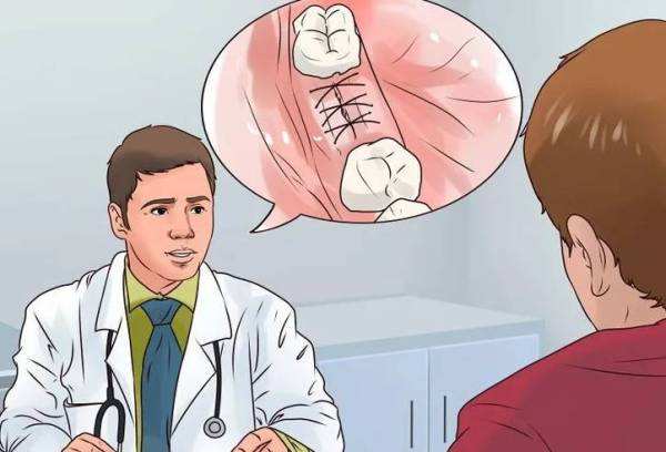 拔智齿最可怕的是不出血,拔智齿吓人不