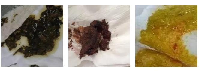 怎么判断喝奶粉有没有过敏,吃了奶粉后吐奶是什么颜色